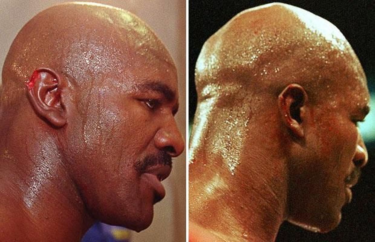 Mike Tyson Arrache L Oreille Mike Tyson rend enfin son oreille à