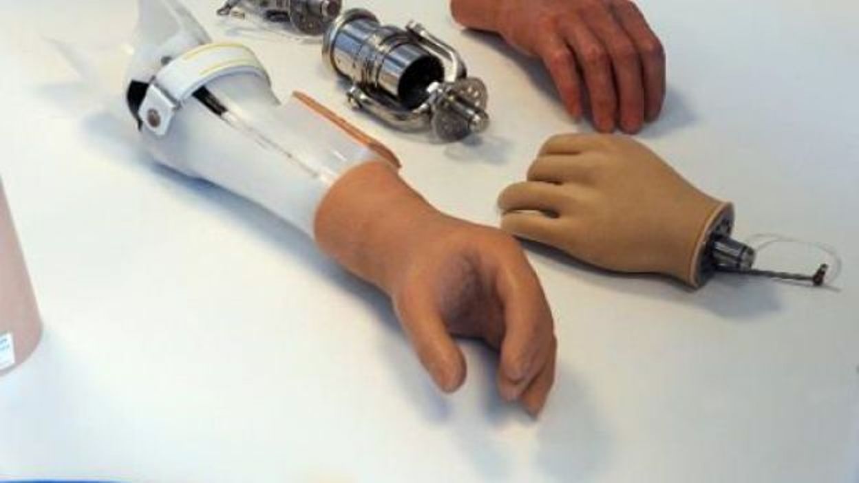 Un paralysé a pu manoeuvrer une prothèse de bras grâce à la pensée