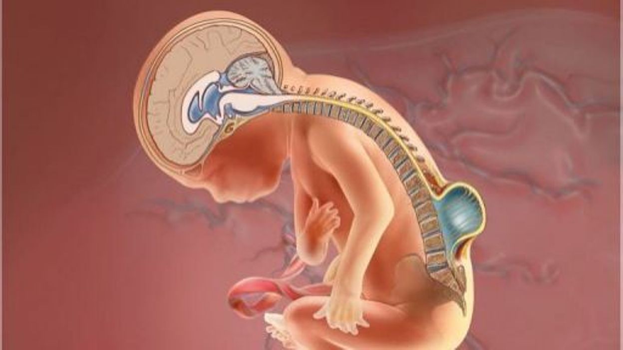 La Chirurgie Sur Le Foetus Peut Corriger Un Defaut De La Colonne Vertebrale