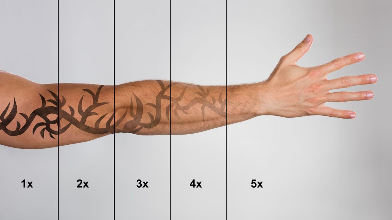 Comment Mieux Effacer Les Tatouages La Science A Son Id e comment-mieux-effacer-les-tatouages-la-science-a-son-id-e