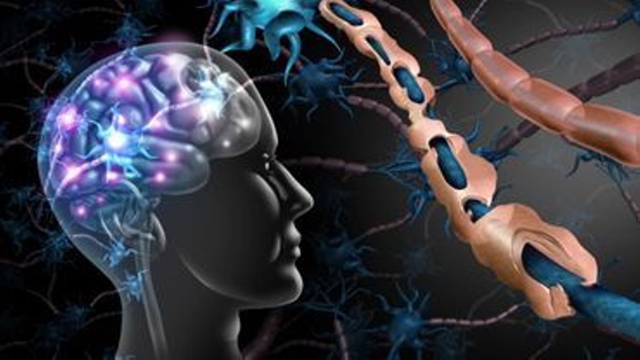 Sclérose en plaques : la perte neuronale est liée à une forte inflammation - Vimarsana News