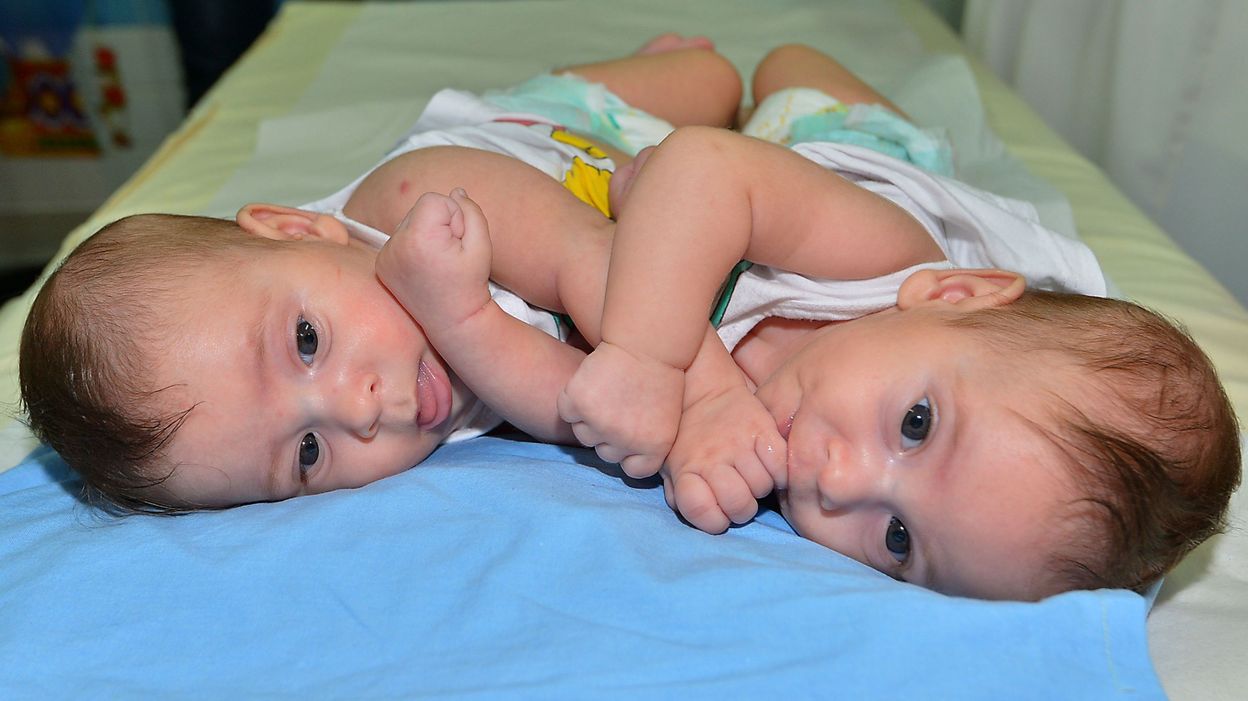 Bebes Siamois De Huit Jours Separes Avec Succes En Suisse