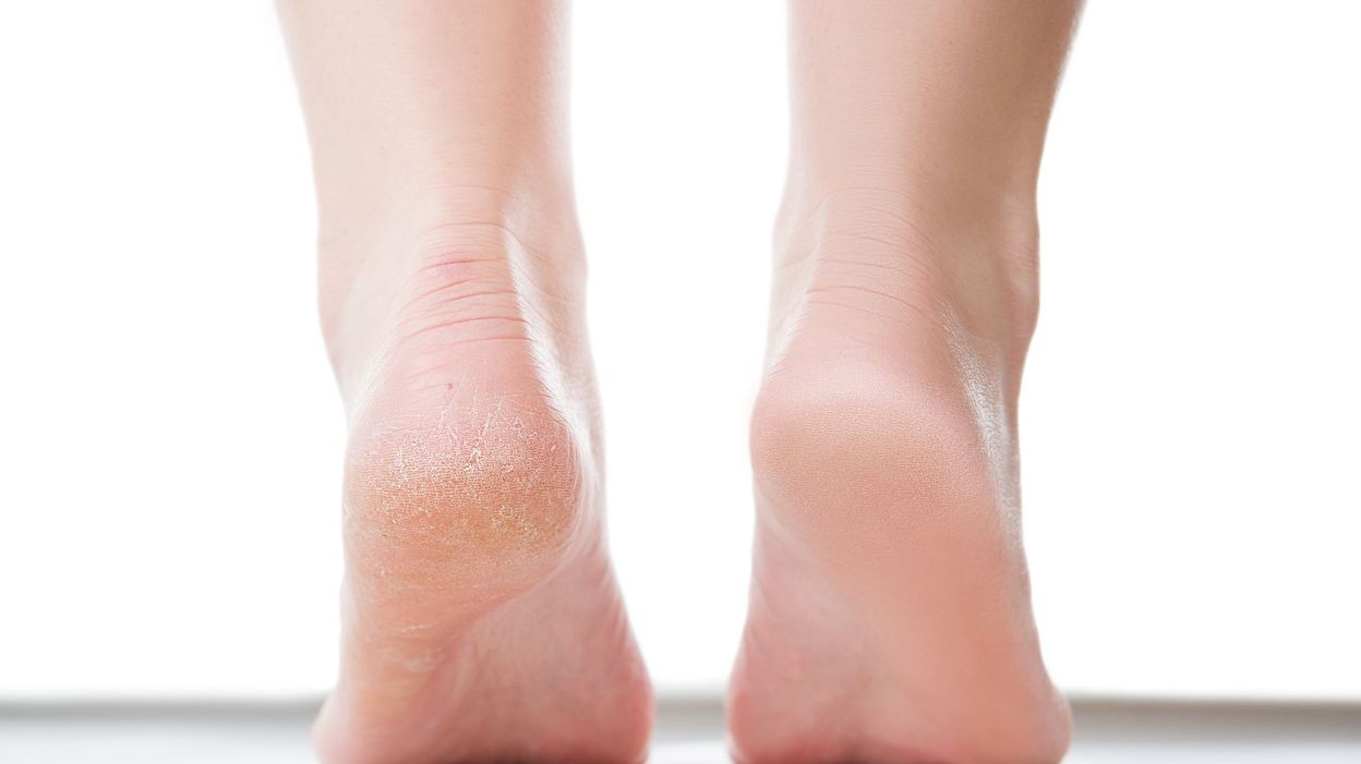 Avoir Des Pieds De Bebe En Enfilant Des Chaussettes Exfoliantes On A Teste