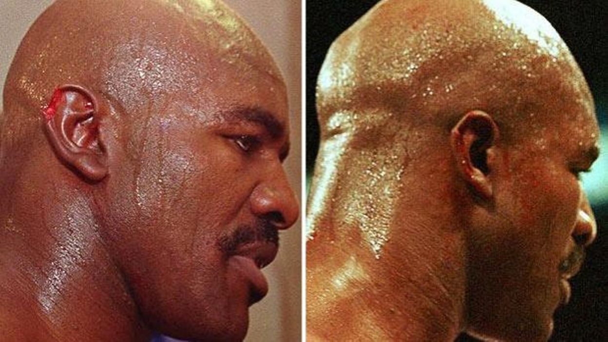 Erstaunlich Mike Tyson Ohr Abgebissen Bild