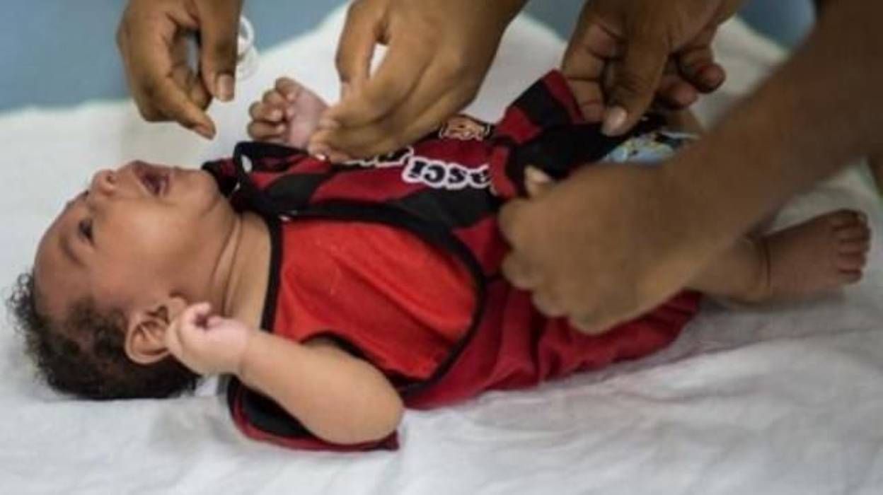 Le Virus Zika Inquiete Mais Le Cytomegalovirus Qui Peut Avoir Les Memes Consequences Est Plus Repandu
