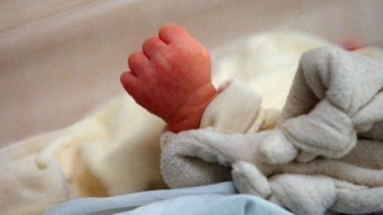 Combien De Naissance Par Jour Dans Le Monde Naissance en Allemagne du bébé le plus prématuré au monde