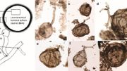 Le champignon fossile Ourasphaira giraldae. La barre d’échelle représente 20 micromètres. Le champignon fossile Ourasphaira giraldae. La barre d’échelle représente 20 micromètres.
