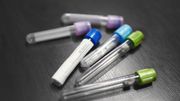 Le don de sang au temps du coronavirus: des tests et un appel aux donneurs Le don de sang au temps du coronavirus: des tests et un appel aux donneurs