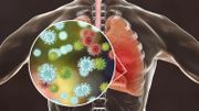 Cure anti-coronavirus: après la chloroquine, le favipiravir japonais (ou Avigan) ? Cure anti-coronavirus: après la chloroquine, le favipiravir japonais (ou Avigan) ?