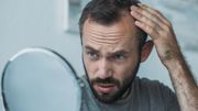 La pollution de l'air contribue-t-elle aussi à la perte des cheveux? La pollution de l'air contribue-t-elle aussi à la perte des cheveux?