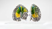 "Le cerveau de Vésale" imprimé par Materialise "Le cerveau de Vésale" imprimé par Materialise