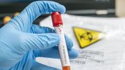 Les tests sérologiques seront finalement disponibles pour tous et remboursés pour certains groupes-cibles Les tests sérologiques seront finalement disponibles pour tous et remboursés pour certains groupes-cibles