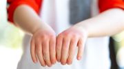 Votre enfant souffre-t-il d'eczéma, la maladie de peau la plus fréquente ? Votre enfant souffre-t-il d'eczéma, la maladie de peau la plus fréquente ?