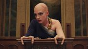 Anne Hathaway représentée avec des mains qui ressemblent fortement à celles de personnes souffrant d'ectrodactylie. Anne Hathaway représentée avec des mains qui ressemblent fortement à celles de personnes souffrant d'ectrodactylie.