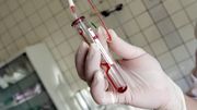 Un pas de plus vers la guérison du SIDA: des chercheurs de l'UZ Gent ont localisé le réservoir viral Un pas de plus vers la guérison du SIDA: des chercheurs de l'UZ Gent ont localisé le réservoir viral
