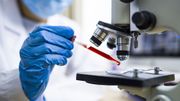 Recherche sur le coronavirus Recherche sur le coronavirus