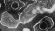 Virus Epstein Barr Virus Epstein Barr