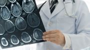 AVC : nos hôpitaux sont-ils bien préparés ? AVC : nos hôpitaux sont-ils bien préparés ?