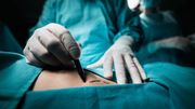 La génération Y ne boude pas la chirurgie esthétique La génération Y ne boude pas la chirurgie esthétique