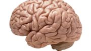 Image d'un cerveau en bonne santé. Image d'un cerveau en bonne santé.