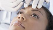 Les injections de Botox sont loin d’être sans risque, alerte une étude britannique Les injections de Botox sont loin d’être sans risque, alerte une étude britannique