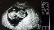 Avez-vous déjà appris la grossesse d'un proche sur Facebook ? Avez-vous déjà appris la grossesse d'un proche sur Facebook ?