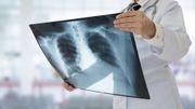 Cancer: des scientifiques ont peut-être trouvé une alternative à la biopsie Cancer: des scientifiques ont peut-être trouvé une alternative à la biopsie