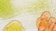 5 précieux conseils pour préparer sa peau au soleil 5 précieux conseils pour préparer sa peau au soleil