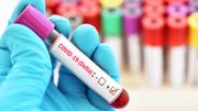Coronavirus : le variant Delta devrait représenter 90% des nouveaux cas dans l'UE d'ici fin août Coronavirus : le variant Delta devrait représenter 90% des nouveaux cas dans l'UE d'ici fin août