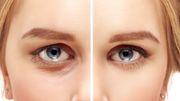 Les rides autour des yeux : comment les éviter naturellement? Les rides autour des yeux : comment les éviter naturellement?