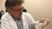 AU CHU de Liège, le professeur Natzi Sakalihasan est un des spécialistes mondiaux de l'Anévrisme de l'Aorte Abdominale AU CHU de Liège, le professeur Natzi Sakalihasan est un des spécialistes mondiaux de l'Anévrisme de l'Aorte Abdominale