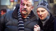 Des manifestants blessés après des affrontements avec les forces de l'ordre, à Kiev Des manifestants blessés après des affrontements avec les forces de l'ordre, à Kiev