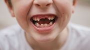 Dents de lait : Soignez-les ! Dents de lait : Soignez-les !