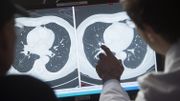 UZ Brussel : tous les patients sont testés pour le coronavirus. Quels résultats? UZ Brussel : tous les patients sont testés pour le coronavirus. Quels résultats?