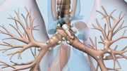 Une méthode pionnière dans le diagnostic du cancer du poumon fait ses preuves à l'hôpital Erasme à Bruxelles Une méthode pionnière dans le diagnostic du cancer du poumon fait ses preuves à l'hôpital Erasme à Bruxelles