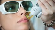 L'épilation laser L'épilation laser