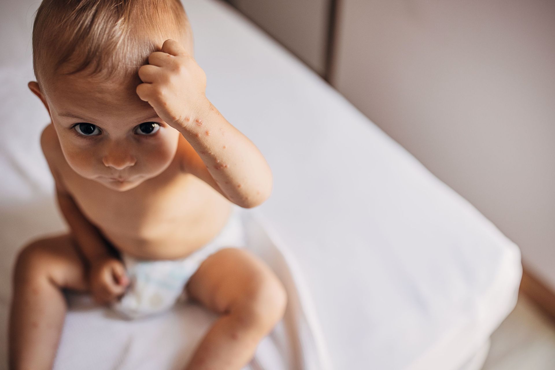 Votre Enfant Est Un Peu Grognon Et Fatigue Il A Peut Etre Le Syndrome Pieds Mains Bouche