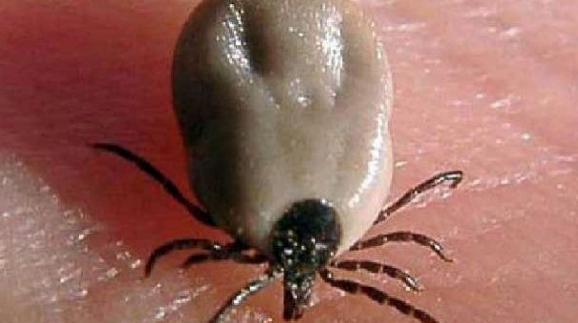 Maladie De Lyme Une Morsure De Tique Ne Signifie Pas L Infection Automatique