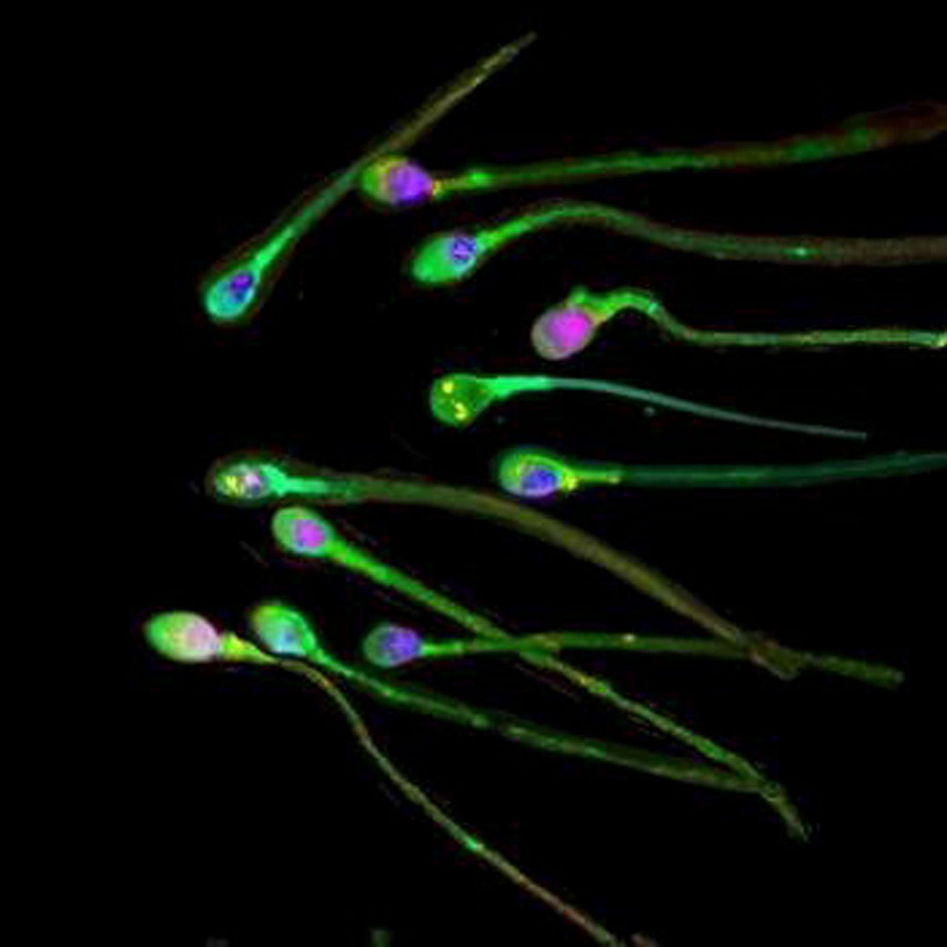 Les Spermatozoides Occidentaux Moins Nombreux Et Moins Qualitatifs