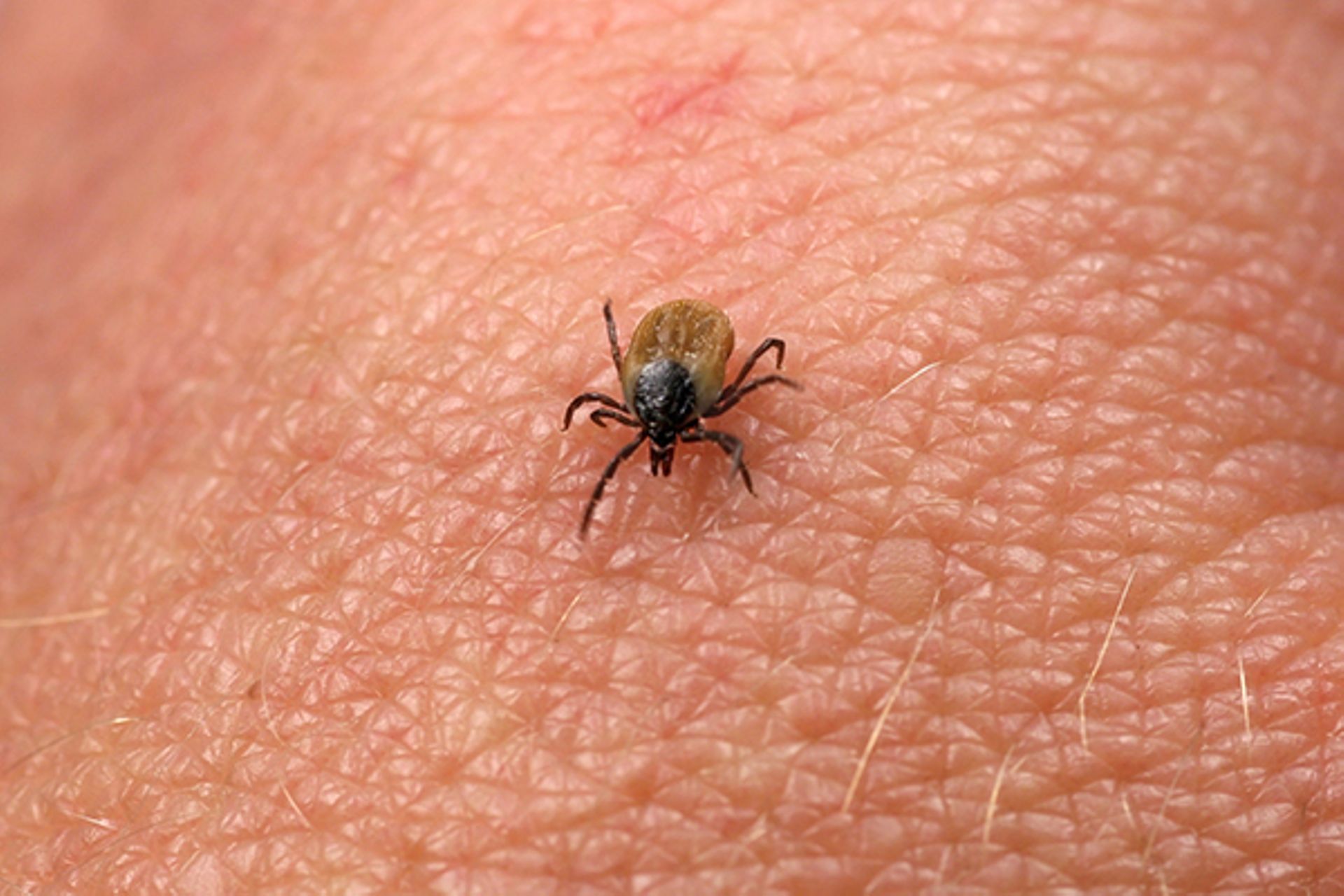 Maladie de Lyme: une étude vante les vertus d'une pommade antibiotique