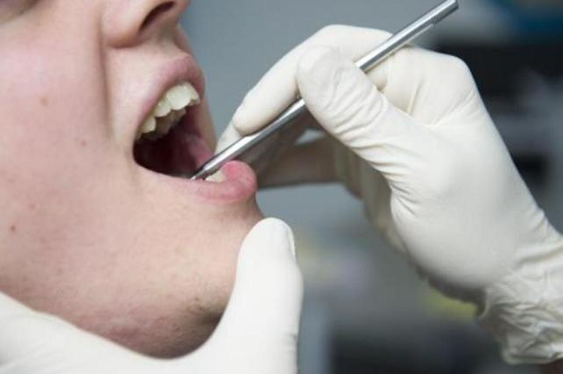Coronavirus Des Masques Non Conformes Delivres Aux Dentistes De Garde
