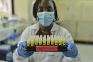 Le Mers-CoV, prochain Coronavirus transmis à l'homme ? Les dromadaires du Kenya sous haute surveillance Le Mers-CoV, prochain Coronavirus transmis à l'homme ? Les dromadaires du Kenya sous haute surveillance