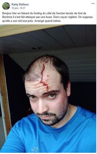 Sur un post Facebook, une photo témoigne de l'attaque d'une buse sur un homme qui faisait son jogging Sur un post Facebook, une photo témoigne de l'attaque d'une buse sur un homme qui faisait son jogging