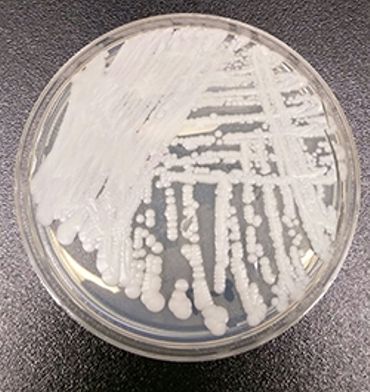 Une souche de Candida auris cultivée dans une boîte de Petri dans un laboratoire aux États-Unis. Une souche de Candida auris cultivée dans une boîte de Petri dans un laboratoire aux États-Unis.