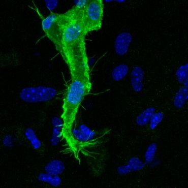 La biologie des tumeurs, Daily Science et la mouche soldat La biologie des tumeurs, Daily Science et la mouche soldat