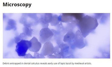 Vue microscopique du bleu trouvé dans le tartre dentaire par l'équipe de Christina Warinner Vue microscopique du bleu trouvé dans le tartre dentaire par l'équipe de Christina Warinner
