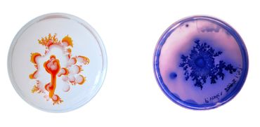 Les assiettes de Vik Muniz pour Bernardaud. Les assiettes de Vik Muniz pour Bernardaud.