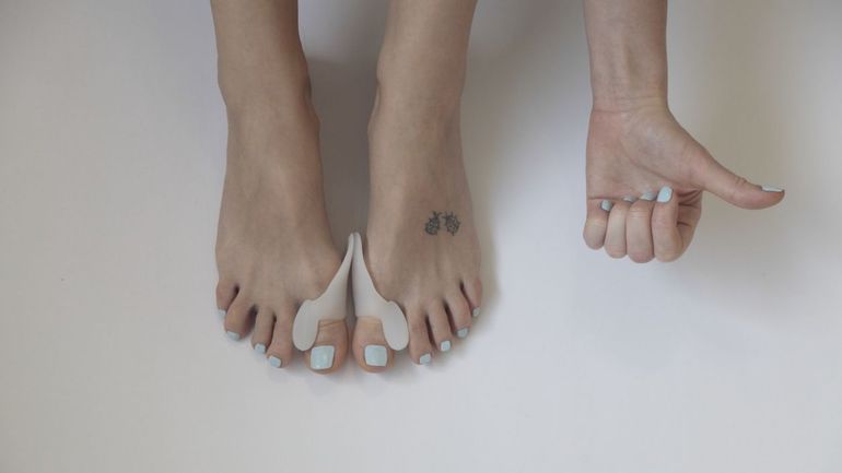 Peut-on Vivre Longtemps Avec Des Stents Quelles chaussures porter quand on a un hallux valgus