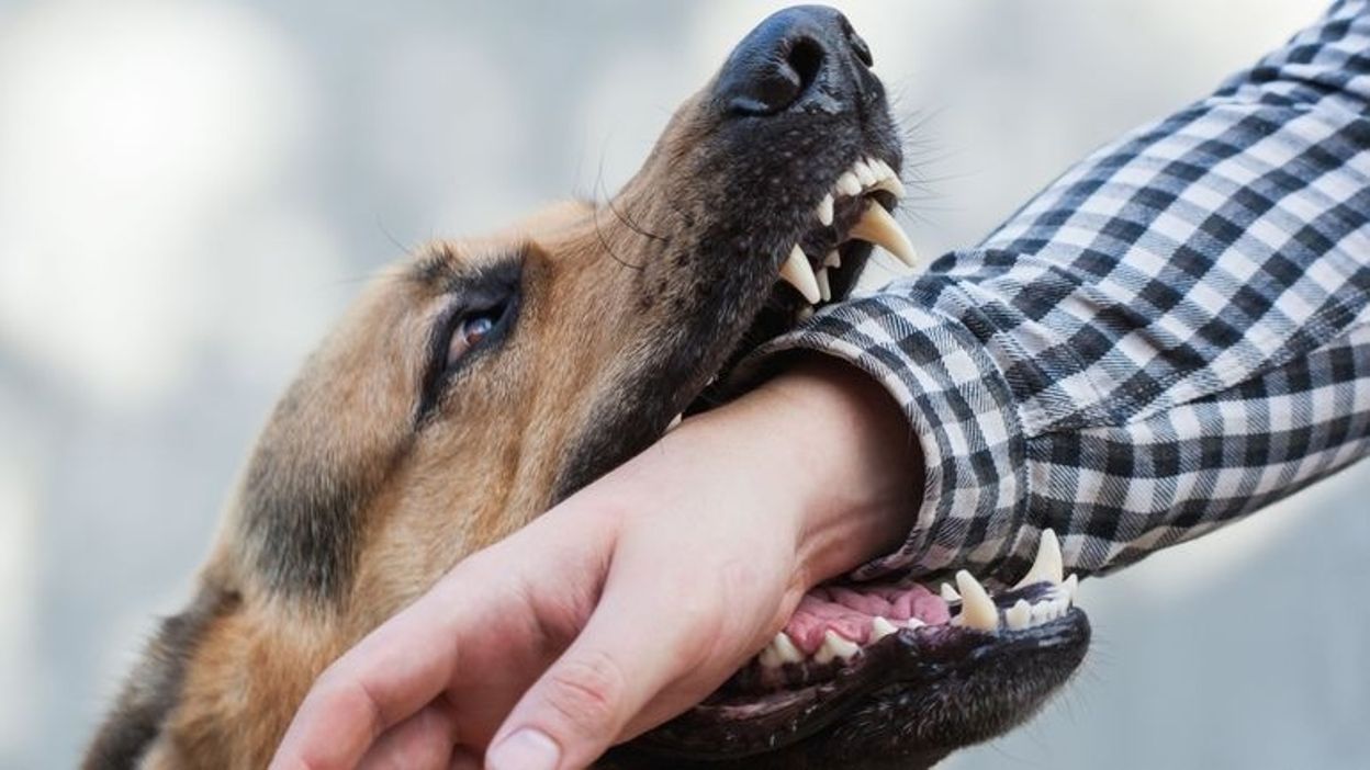 Que faire en cas de morsure de chien ? - RTBF Actus