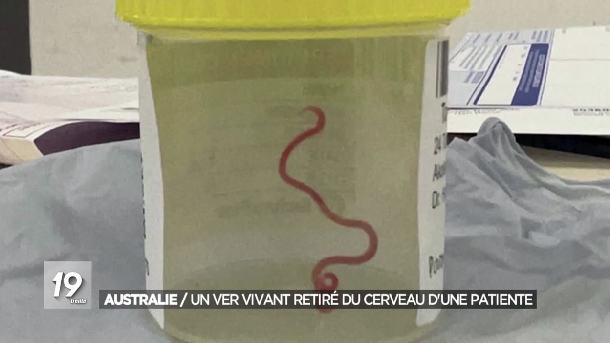 Ver Vivant Cerveau Australie Frikg-RqmQLOUM